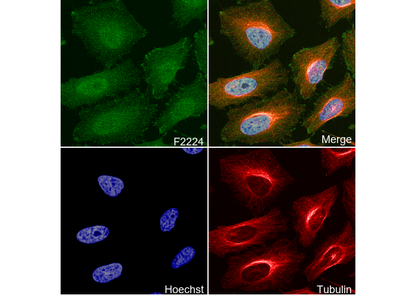 Cytokeratin 15 Antibody