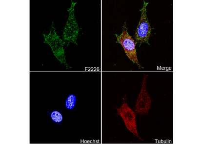 α smooth muscle Actin (acetyl Glu3) + Actin γ2 (acetyl Glu3) Antibody