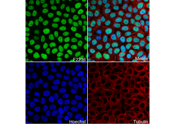FTO Antibody