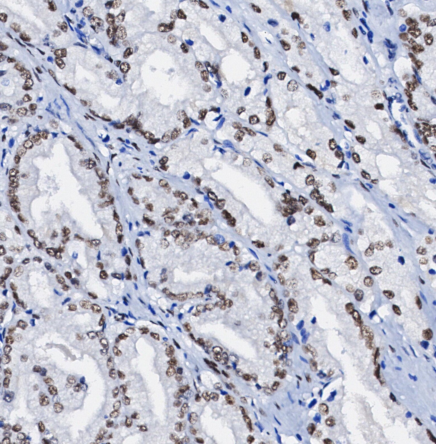 FTO Antibody
