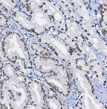 FTO Antibody