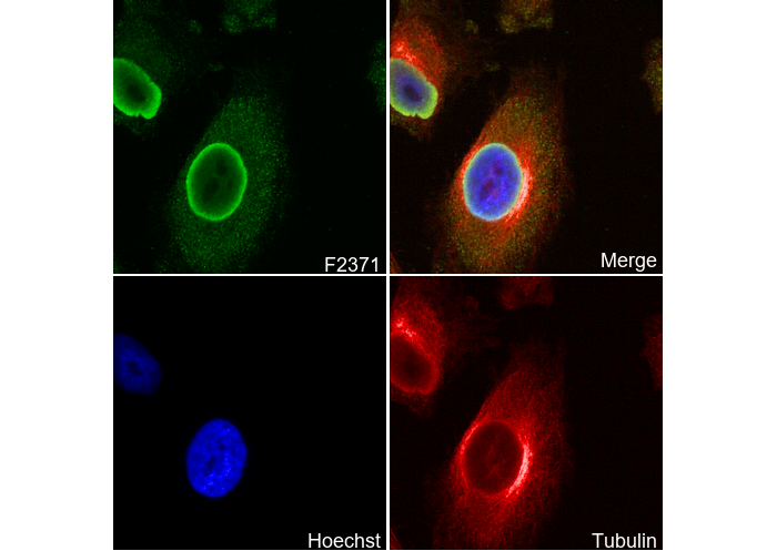 hnRNP K Antibody