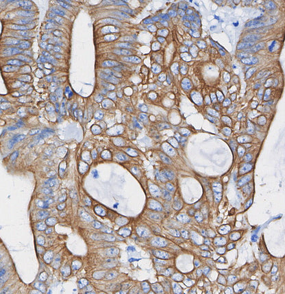 Keratin 12/K12 Antibody