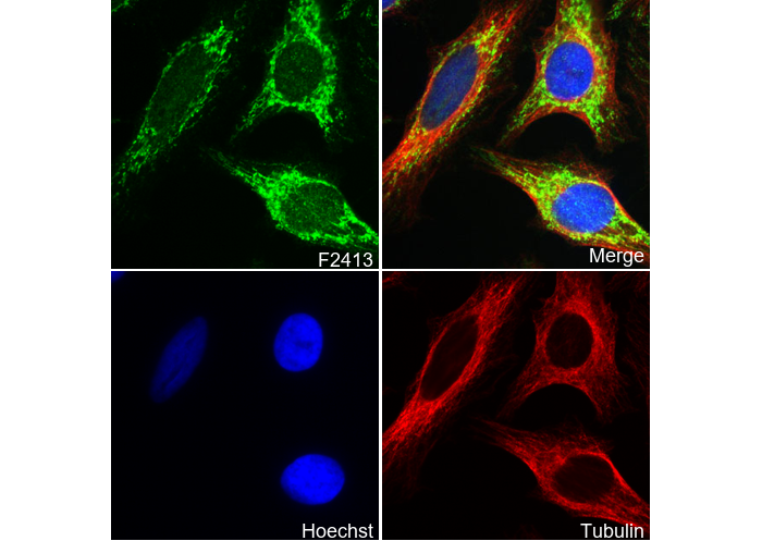 ACADM/MCAD Antibody