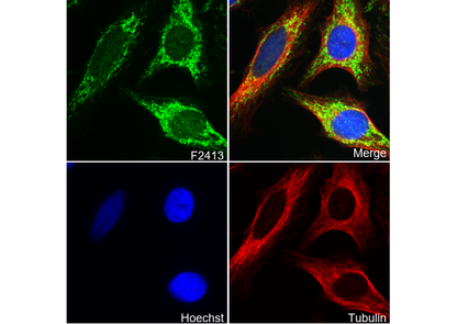 ACADM/MCAD Antibody