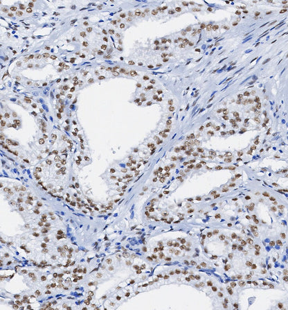 FLI1 Antibody