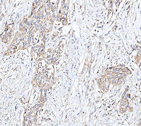 RANK Antibody