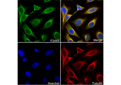 Calpain 1 Antibody