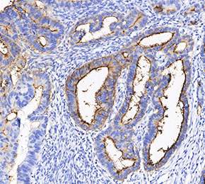 CA19-9 Antibody