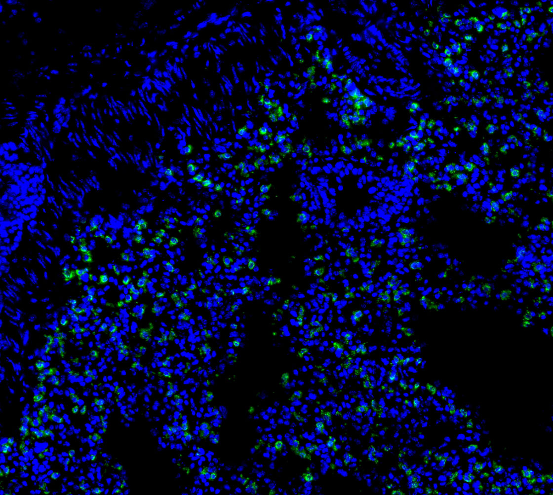 Prosurfactant Protein C Antibody