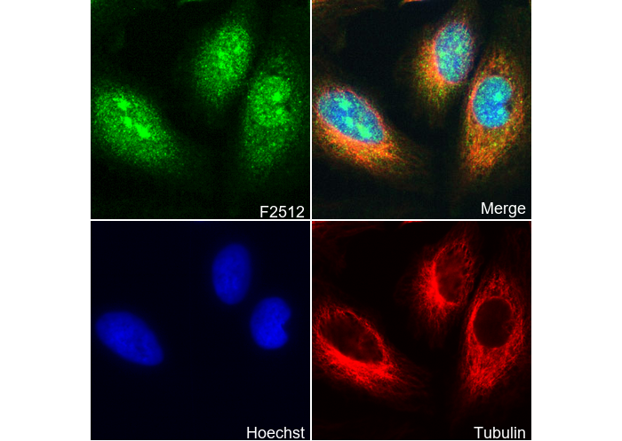 Phospho-STAT3 (Tyr705) (L7D9) Antibody