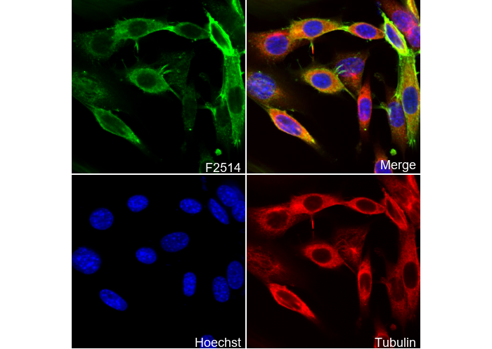 α smooth muscle Actin / α-SMA Antibody