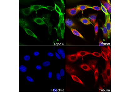 α smooth muscle Actin / α-SMA Antibody