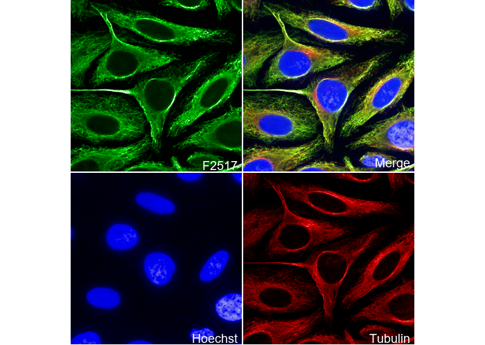 Vimentin Antibody