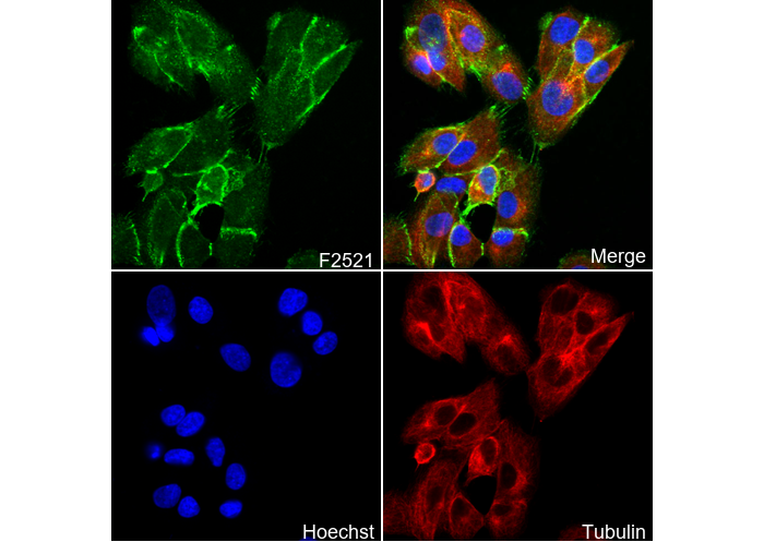 β-Catenin Antibody