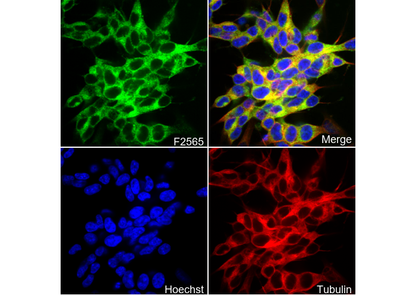 PFKM Antibody