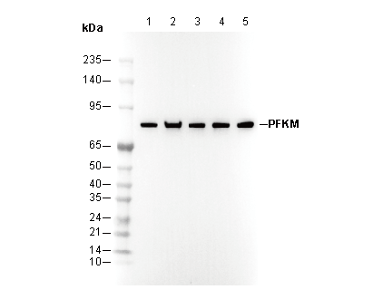 PFKM Antibody