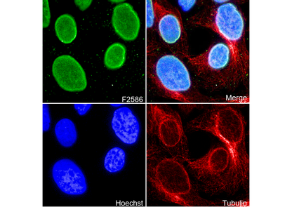 E2F1 Antibody