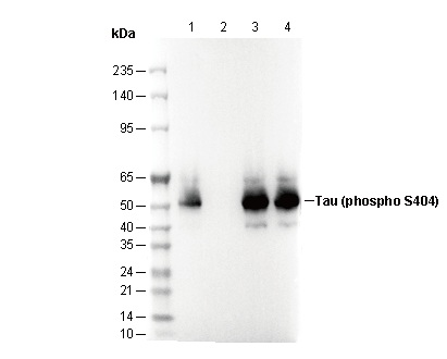 Phospho-Tau (Ser404) Antibody