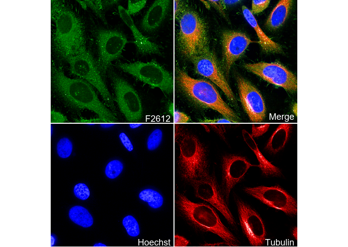 ARPC2 Antibody