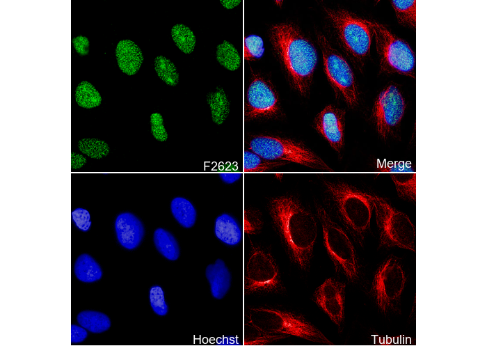 PARP1 Antibody