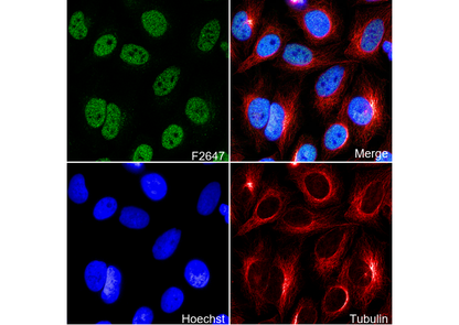 STAG2 Antibody