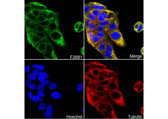 Cytokeratin 5 Antibody