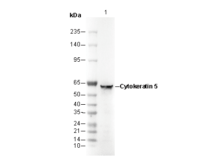 Cytokeratin 5 Antibody