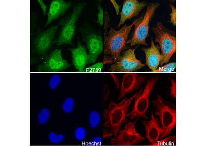 4E-BP1 Antibody