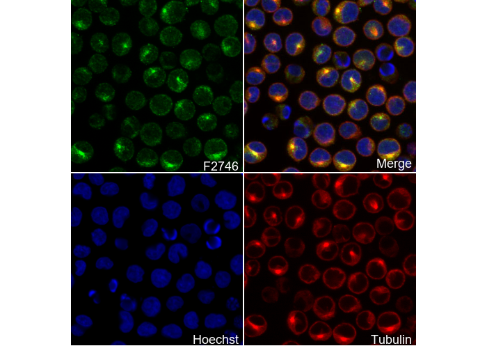 GGT1/GGT Antibody