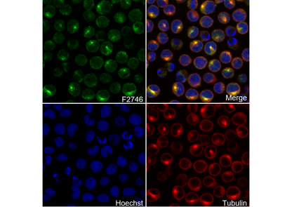 GGT1/GGT Antibody