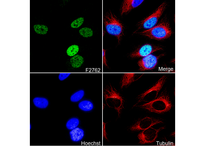 FUBP1 Antibody