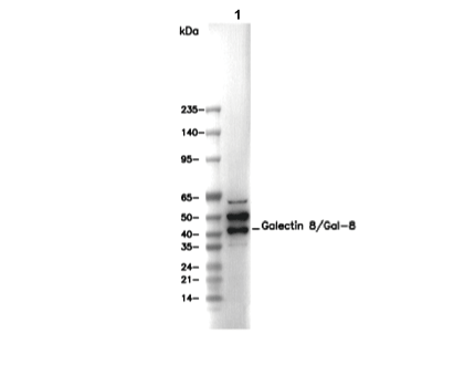 Galectin 8/Gal-8 Antibody