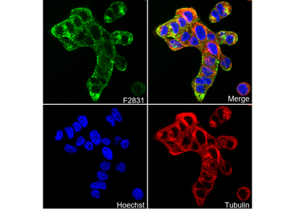 Desmoplakin I+II Antibody