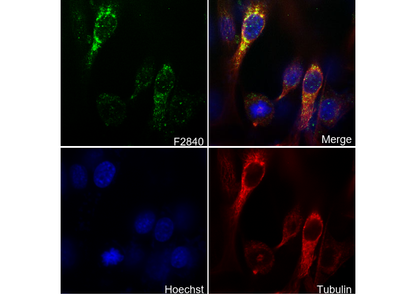 ATP6V1A Antibody