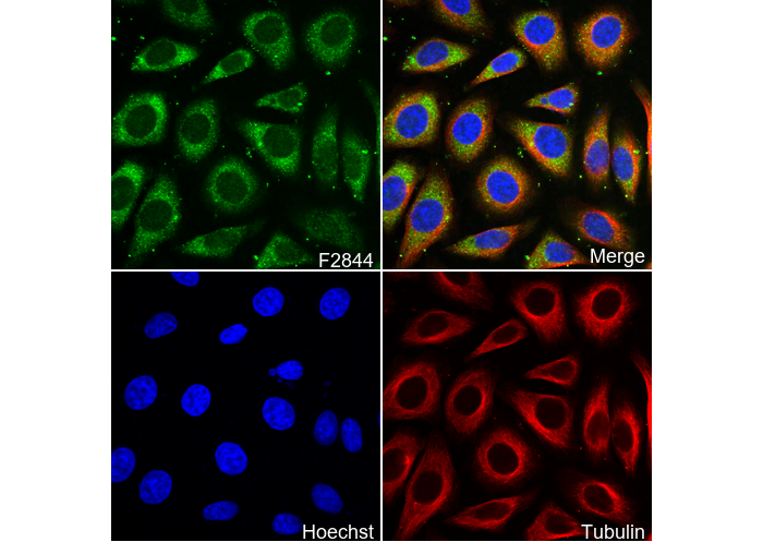 Prostaglandin D Synthase (Lipocalin)/PDS Antibody