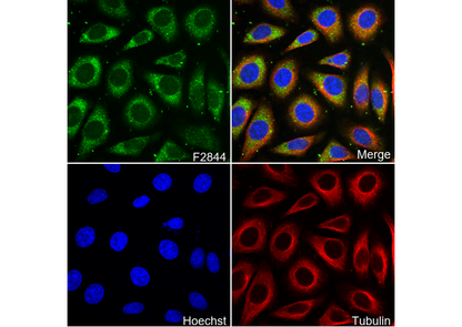 Prostaglandin D Synthase (Lipocalin)/PDS Antibody