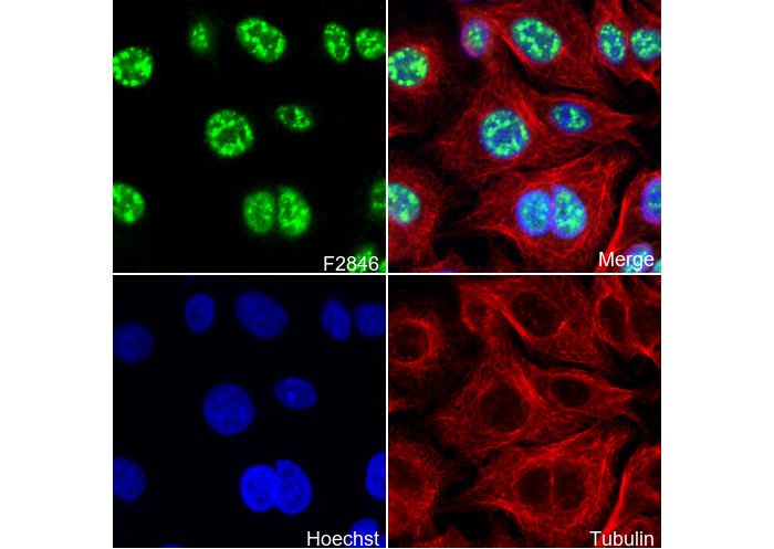 Phospho-Smad3 (Ser423/Ser425) Antibody