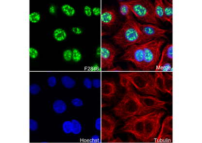 Phospho-Smad3 (Ser423/Ser425) Antibody
