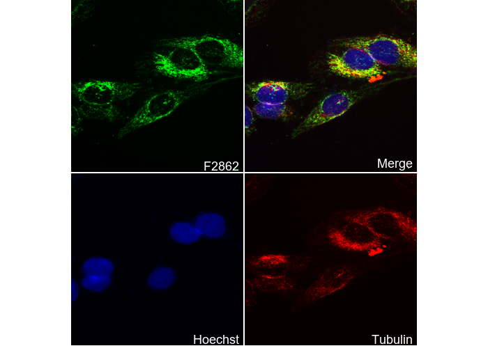 Hexokinase II Antibody