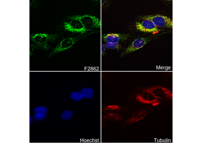 Hexokinase II Antibody
