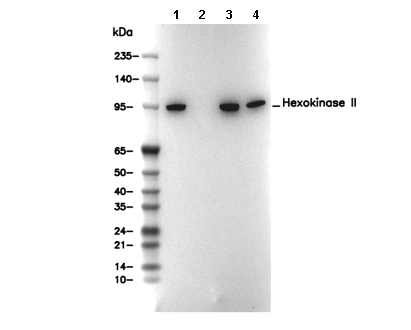 Hexokinase II Antibody