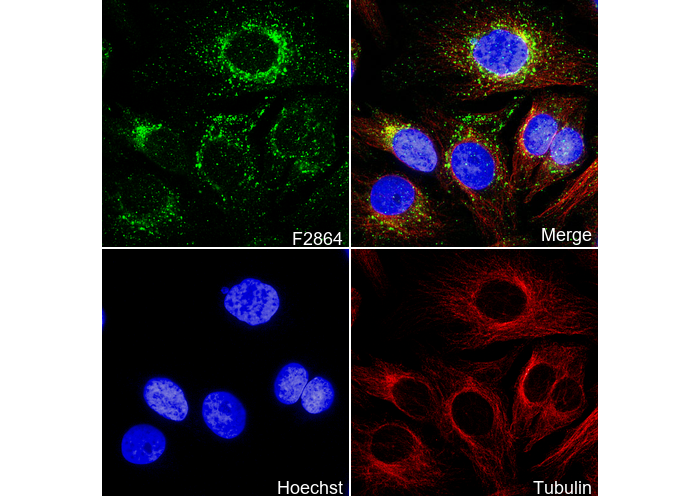 RAB7 Antibody