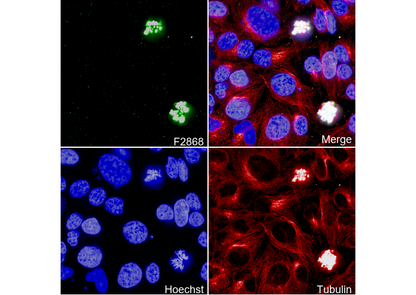 Phospho-Histone H3 (Ser10) Antibody