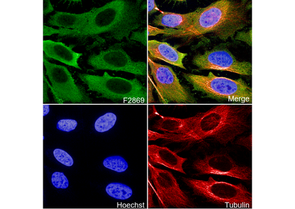 Fatty Acid Synthase Antibody