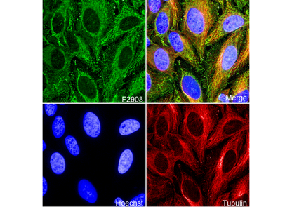 TOMM22/TOM22 Antibody