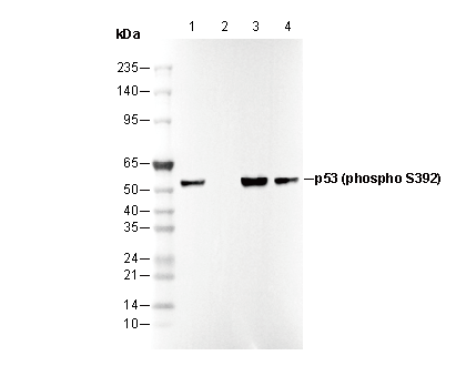 Phospho-p53 (Ser392) Antibody