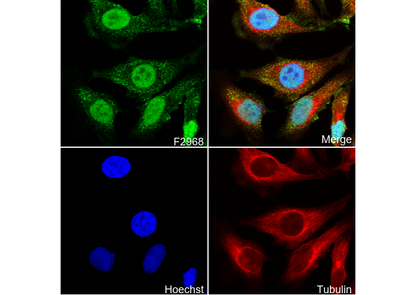 SSB Antibody