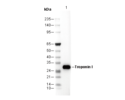 Troponin I Antibody