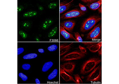 Fibrillarin Antibody